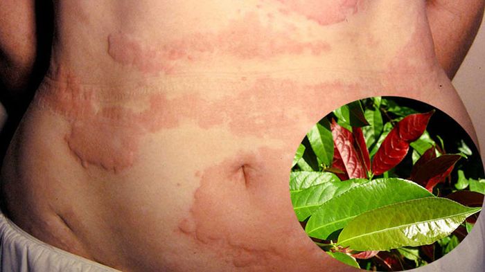 Cây đơn đỏ thường được dùng để trị một số bệnh ngoài da